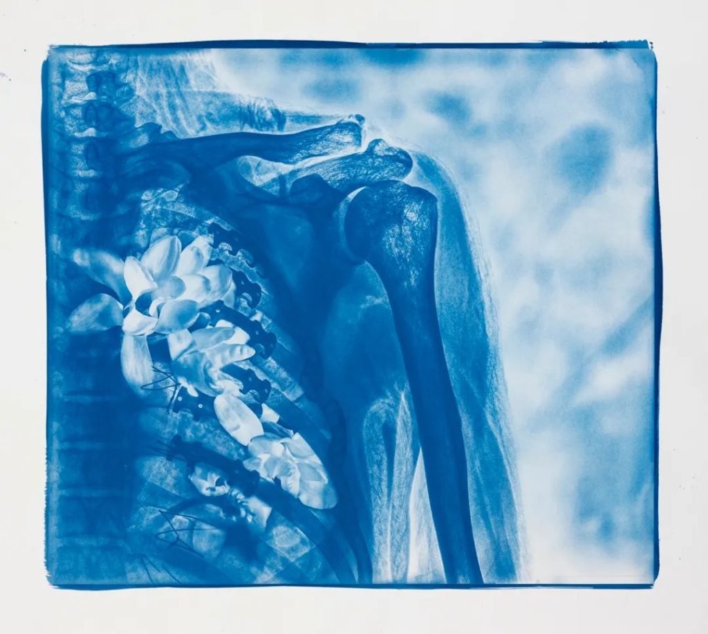 Hu Weiyi, Blue Bones No. 6, 2020